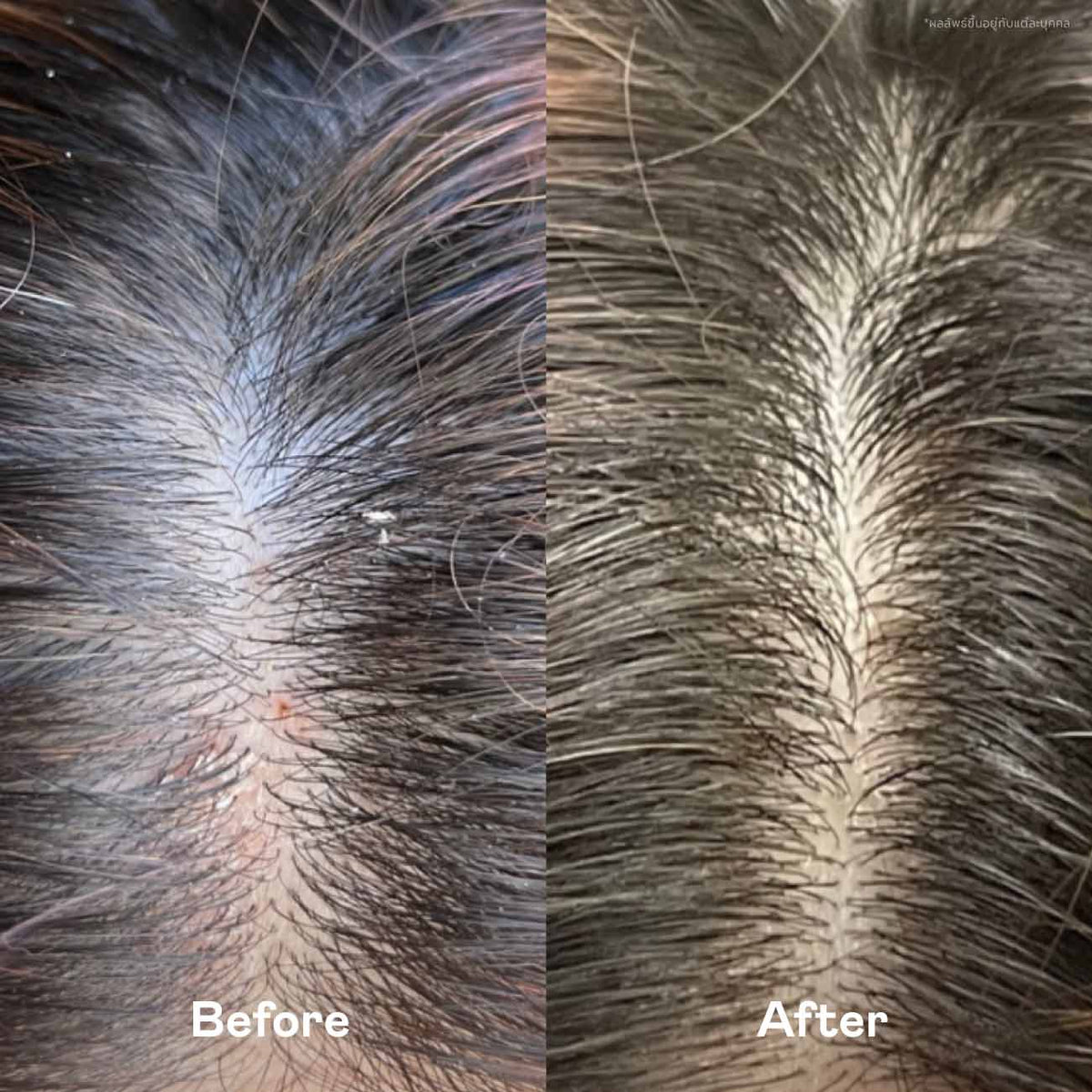 Shampoo & Serum Duo