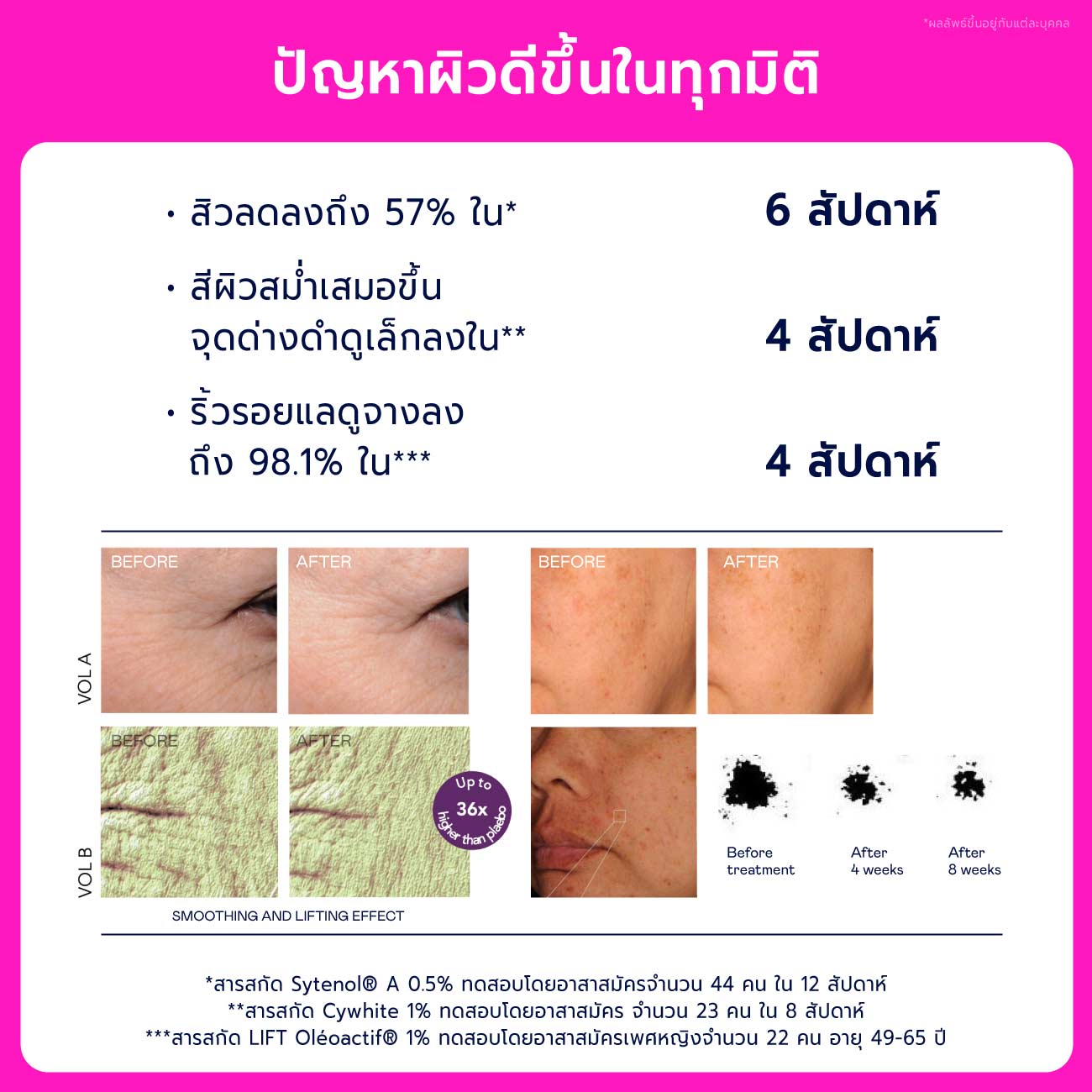 Songkran Anti-Ageing Set