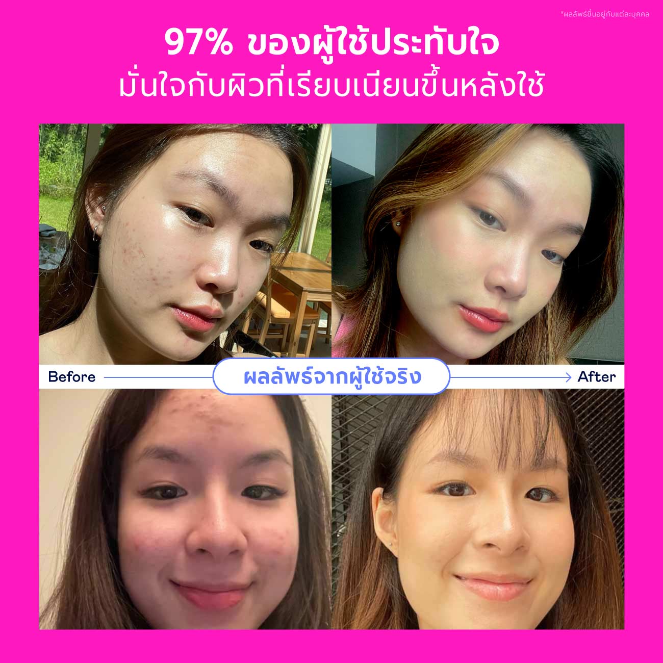 Songkran Skincare Set