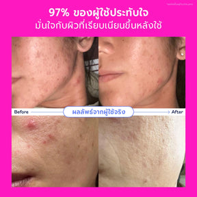 Songkran Skincare Set