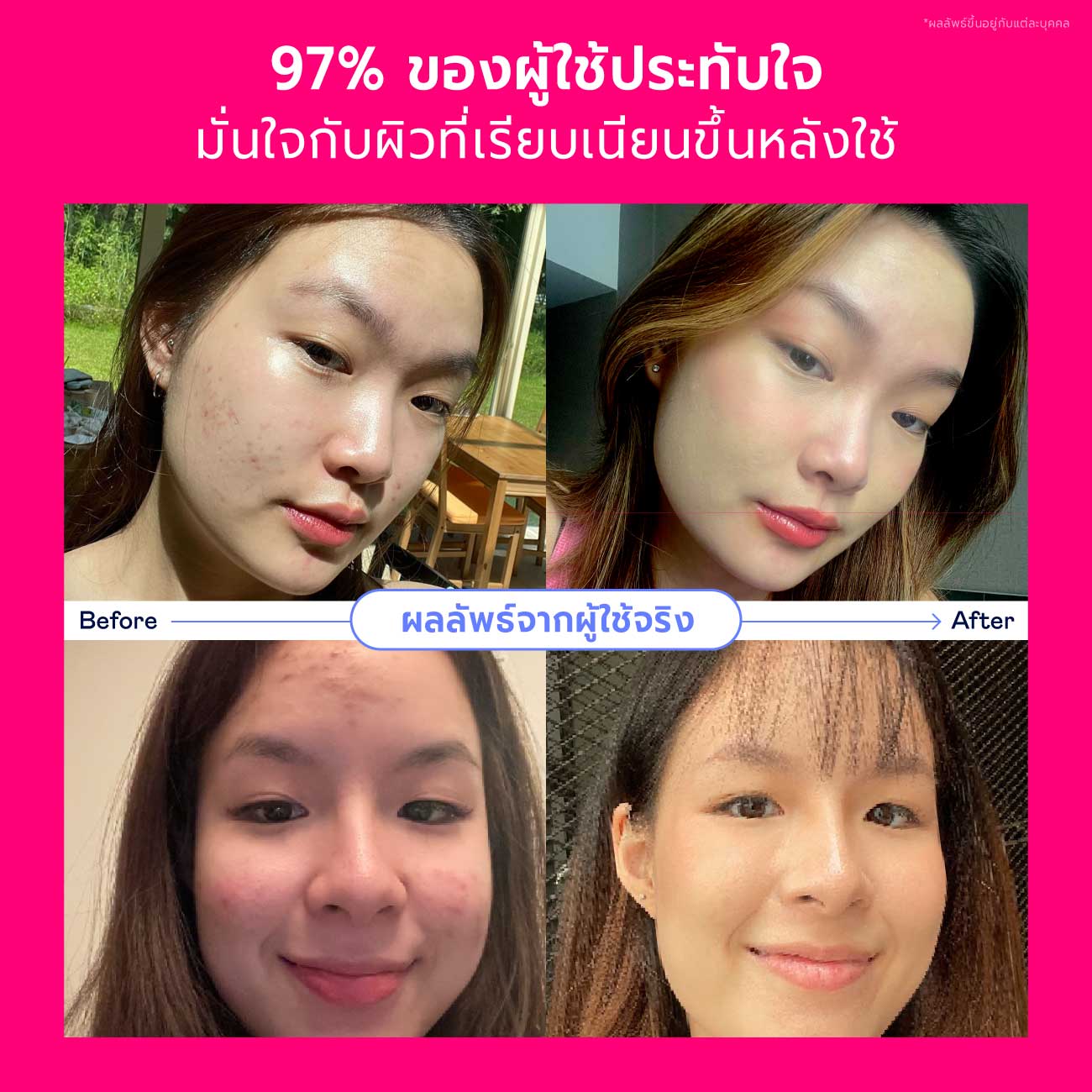 Valentine's Skincare Set