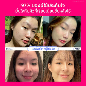 Valentine's Skincare Set