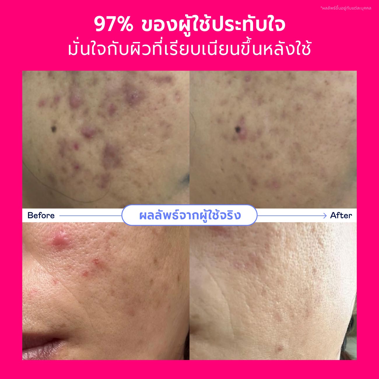 Valentine's Skincare Set