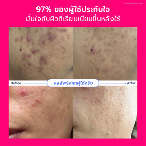 Valentine's Skincare Set