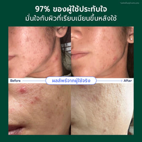 Christmas Skincare Gift Set